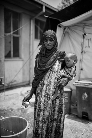 Medina Hamedu (mother) with 2yo Hadi Mohammed with severe acute malnutrition, Dubti Hospital