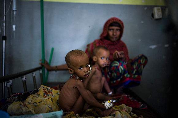 Hasna Mohammed and Asima Mohammed, 1yo twins. Severe acute malnutrition